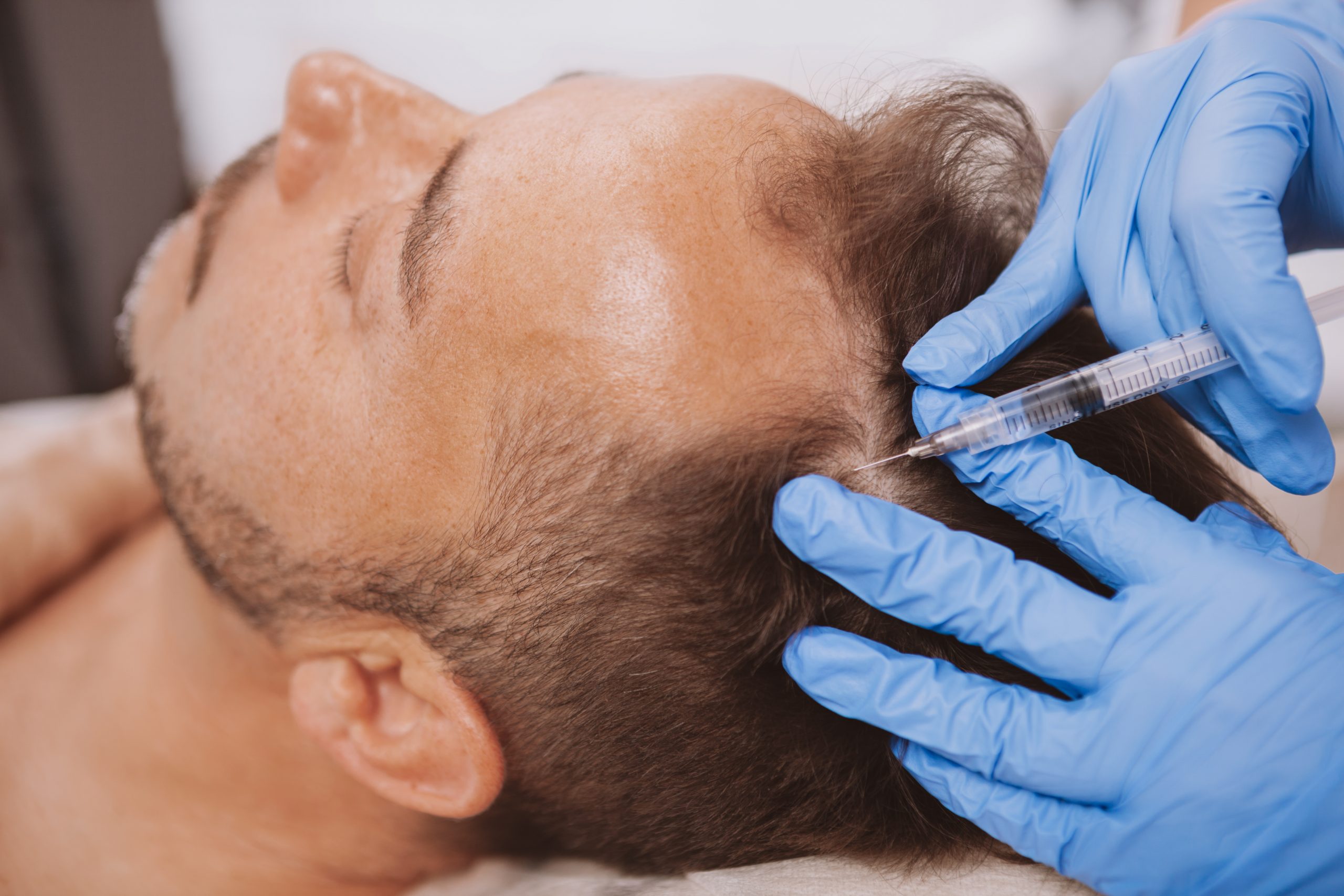Hair restoration