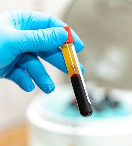 Natural Growth Factor Injections
