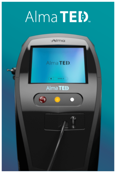 Alma TED Hair Restoration