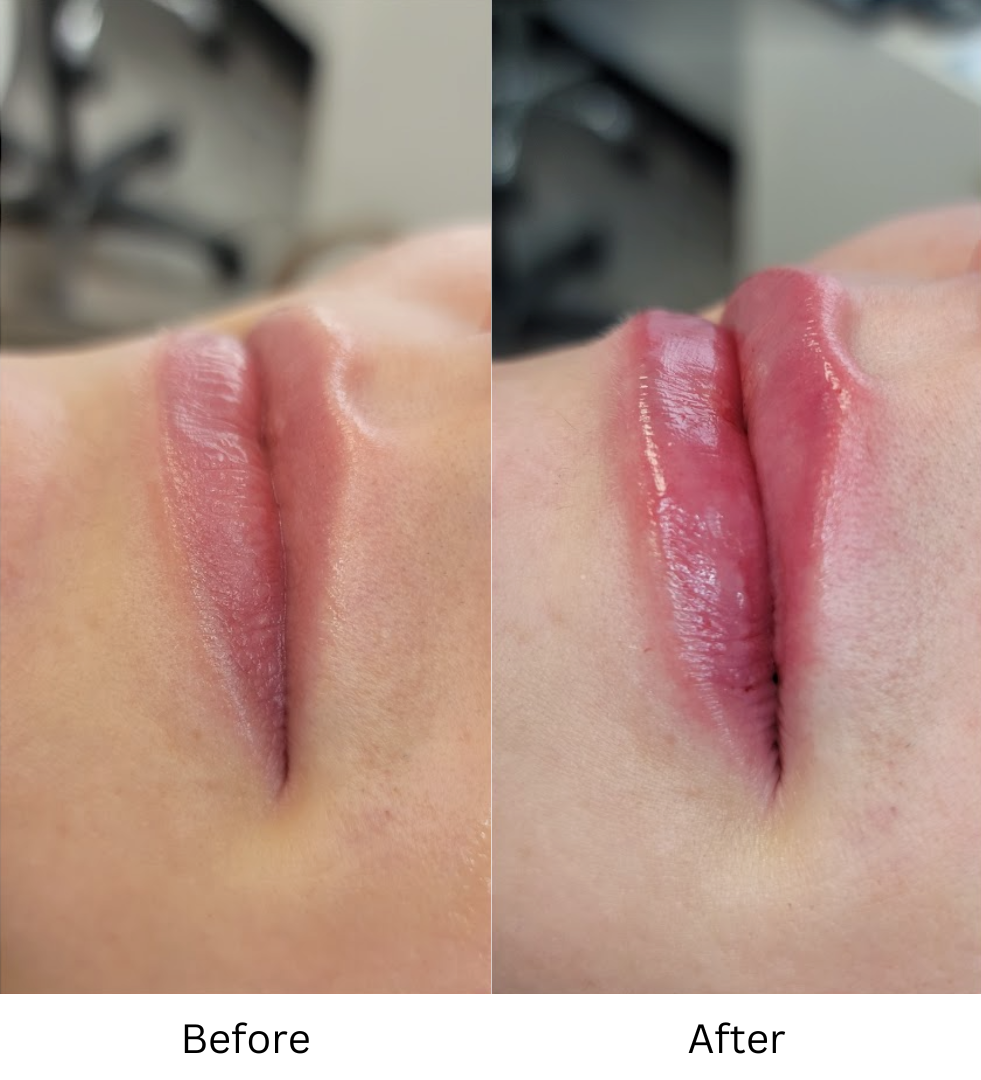 Lips